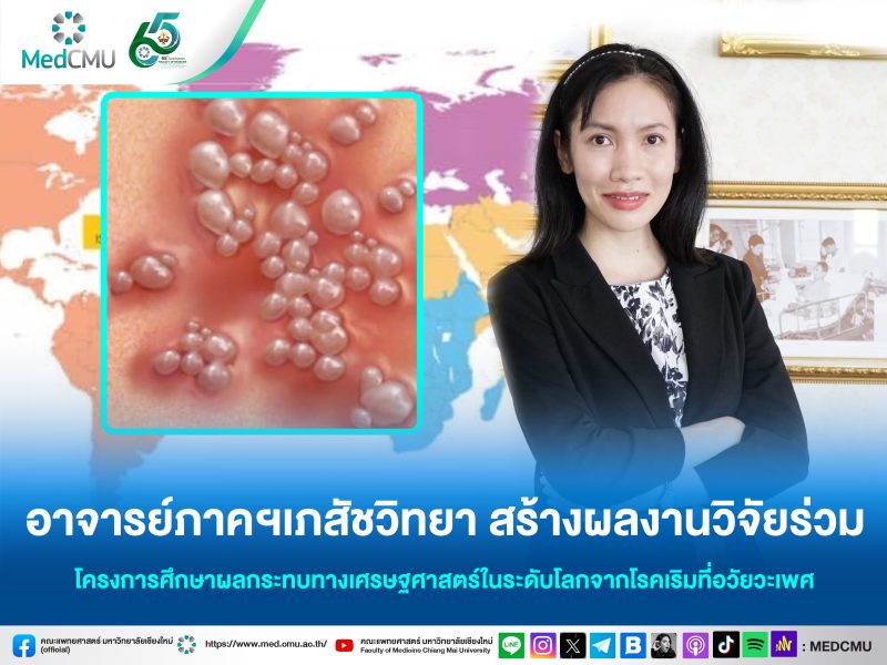 วิจัยเริม