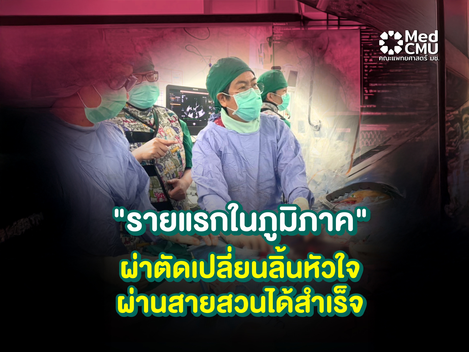 ผ่าตัดหัวใจ